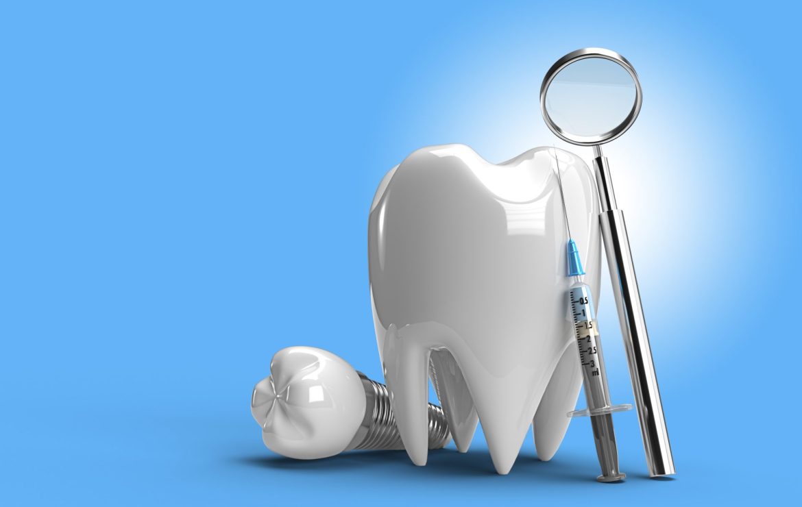 De ce să alegi sistemele de implant dentar performante, în locul celor cu buget redus